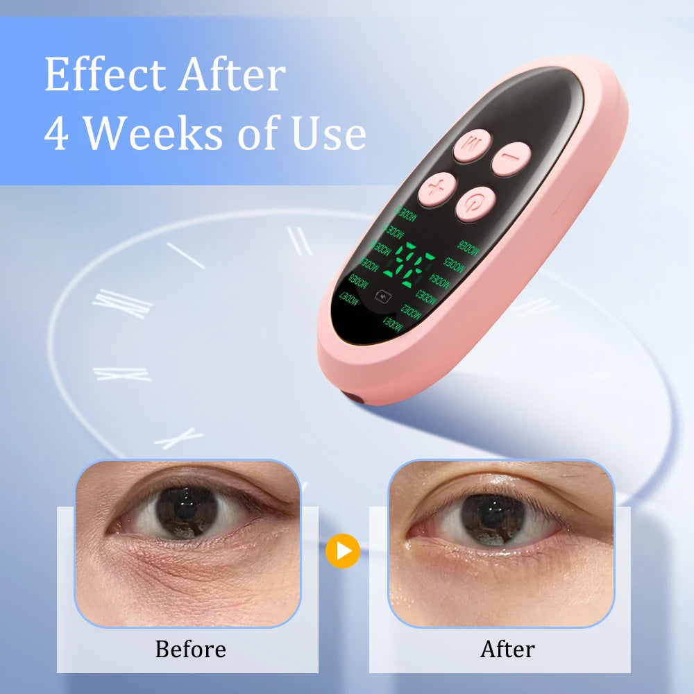 EMS Facial Massager – Microcurrent Muscle Stimulator for Lifting, Tightening & Anti-Wrinkle
